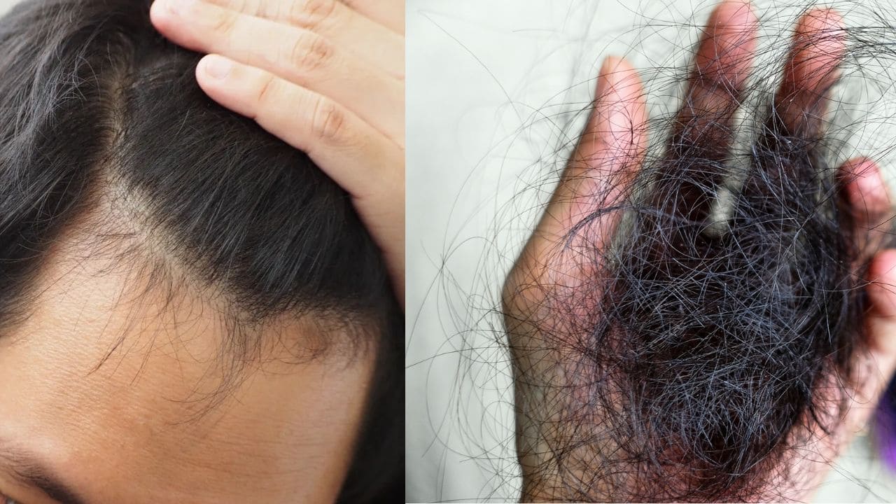 Hair Health Care Tips: सर्दियों के दौर मे झड़ रहे बालो से घर का फर्श हों रहा हैं काला, तो ऐसे बनाएं मजबूत